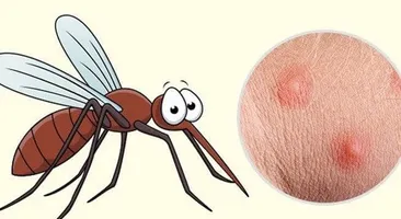 Gợi ý cho mẹ: 5 cách làm dịu da bé khi bị muỗi đốt