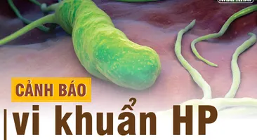 Tìm hiểu phác đồ điều trị vi khuẩn HP kháng thuốc