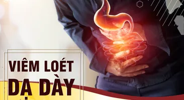 Viêm loét dạ dày và cách điều trị trong Đông Y