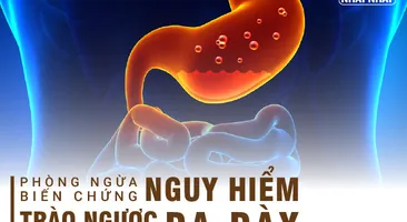 Phòng ngừa biến chứng nguy hiểm do trào ngược dạ dày thực quản