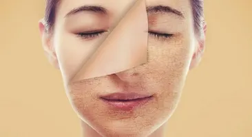 Tại sao da mặt căng rát vào mùa đông và cách khắc phục?