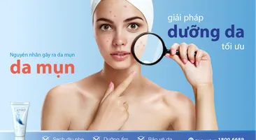 Nguyên nhân gây ra da mụn và giải pháp dưỡng da tối ưu