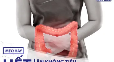 Tổng hợp các mẹo hay hết ăn không tiêu chướng bụng