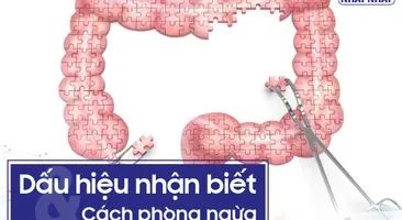 Dấu hiệu nhận biết và cách phòng ngừa viêm đại tràng mãn tính
