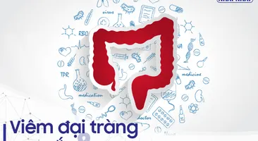 Viêm đại tràng co thắt và những điều cần biết