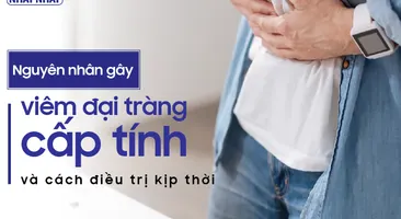 Các nguyên nhân gây viêm đại tràng cấp tính và cách điều trị kịp thời