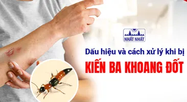 Dấu hiệu và cách xử lý khi bị kiến ba khoang đốt