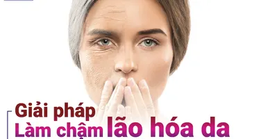 Giải pháp làm chậm lão hóa da tuổi trung niên