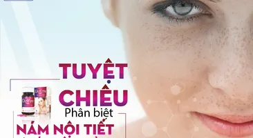 Phân biệt nám nội tiết và nám môi trường