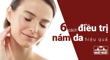 6 cách điều trị nám da mặt hiệu quả mà phụ nữ thông minh tin chọn