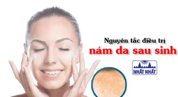 Nguyên tắc điều trị nám da sau sinh cho da sáng mịn màng, không tì vết