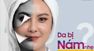 Da bị nám nhẹ nên xử trí thế nào cho hiệu quả?