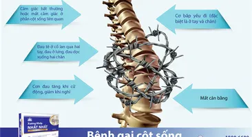 Bệnh gai đốt sống: Nguyên nhân, triệu chứng và điều trị