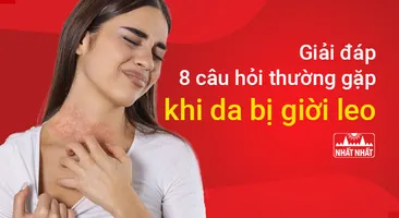Giải đáp 8 câu hỏi thường gặp khi da bị giời leo