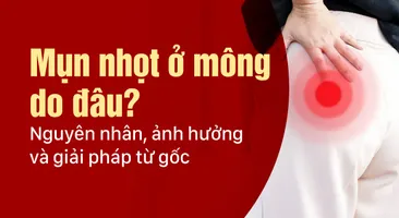 Mụn nhọt ở mông do đâu? Nguyên nhân, ảnh hưởng và giải pháp từ gốc