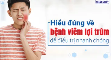 Hiểu đúng về bệnh viêm lợi trùm để điều trị nhanh chóng