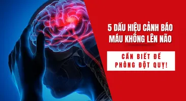 5 dấu hiệu cảnh báo máu không lên não – cần biết để phòng đột quỵ!