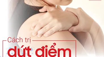 Cách trị dứt điểm đau mỏi vai gáy ở người trẻ tuổi