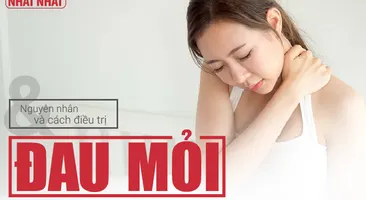 Nguyên nhân và cách điều trị đau mỏi vai gáy khi ngủ dậy