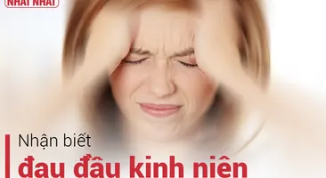 Nhận biết loại bệnh đau đầu kinh niên và cách điều trị hiệu quả