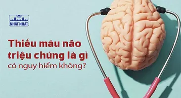 Thiếu máu não triệu chứng là gì? Khi nào nguy hiểm?