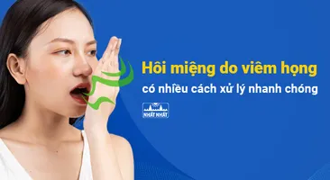 Hôi miệng do viêm họng: có nhiều cách xử lý nhanh chóng !