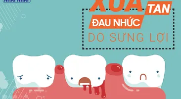 Xua tan đau nhức do sưng lợi