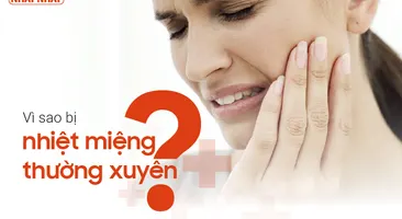 Vì sao bị nhiệt miệng thường xuyên và cách điều trị dứt điểm