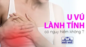 U vú lành tính có nguy hiểm không, khi nào nên mổ?