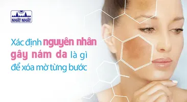 Xác định nguyên nhân gây nám da là gì để xóa mờ từng bước