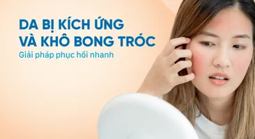 Da bị kích ứng và khô bong tróc: Giải pháp phục hồi nhanh