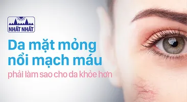 Da mặt mỏng nổi mạch máu phải làm sao cho da khỏe hơn?