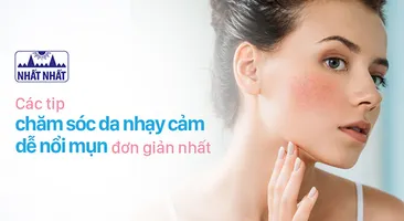 Những cách đơn giản nhất để chăm sóc da nhạy cảm dễ nổi mụn
