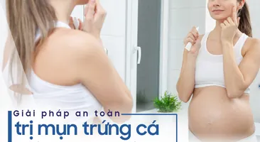 Giải pháp dùng thuốc an toàn để trị mụn trứng cá khi mang thai