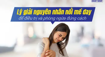 Lý giải nguyên nhân nổi mề đay để điều trị và phòng ngừa đúng cách