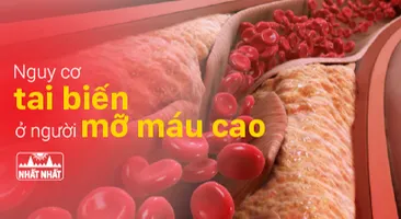 Nhận biết sớm nguy cơ tai biến ở người mỡ máu cao
