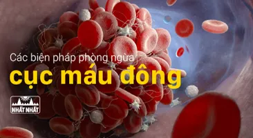 Các biện pháp phòng ngừa cục máu đông một cách tự nhiên