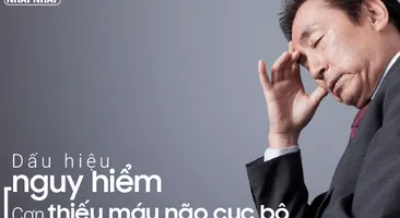 Cơn thiếu máu não cục bộ thoáng qua – Cảnh báo các dấu hiệu nguy hiểm