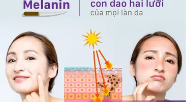 Melanin - "Con dao hai lưỡi" của mọi làn da