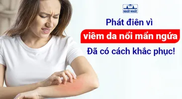Phát điên vì viêm da nổi mẩn ngứa: đã có cách khắc phục!