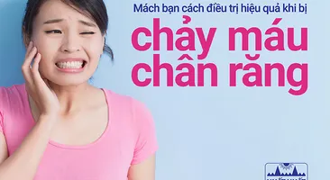 Mách bạn cách điều trị chảy máu chân răng hiệu quả