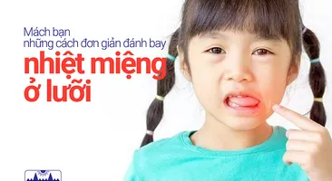Mách bạn những cách đơn giản đánh bay nhiệt miệng ở lưỡi