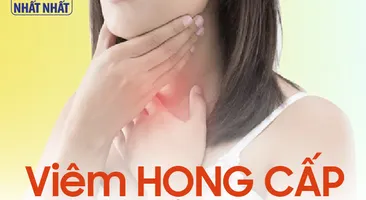 Viêm họng cấp: nên uống thuốc ngay hay chờ tự khỏi?