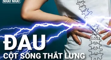 Đau cột sống thắt lưng: Không điều trị ngay dễ tàn phế suốt đời!