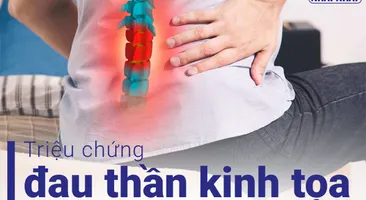Triệu chứng đau thần kinh tọa phổ biến và các bài tập giảm đau hiệu quả 