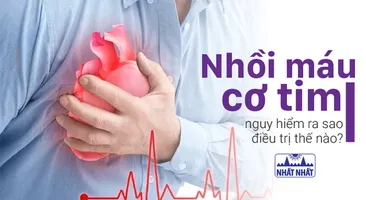 Nhồi máu cơ tim: nguy hiểm ra sao, điều trị thế nào?