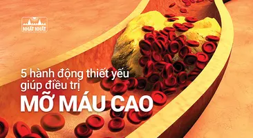 5 hành động thiết yếu giúp điều trị mỡ máu cao