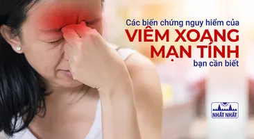 Các biến chứng nguy hiểm của viêm xoang mạn tính bạn cần biết 