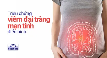 Những triệu chứng viêm đại tràng mạn tính điển hình, dễ nhận biết