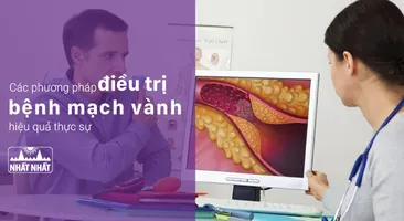 Các phương pháp điều trị bệnh mạch vành hiệu quả thực sự